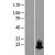 Western Blot: alpha Synuclein Lysate [NBL1-16274] - Western Blot experiments.  Left-Control; Right -Over-expression Lysate for SNCA.